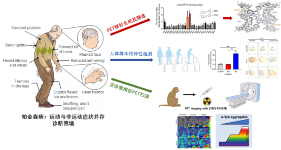 CELL | 新型示踪剂可特异识别帕金森病重要致病蛋白